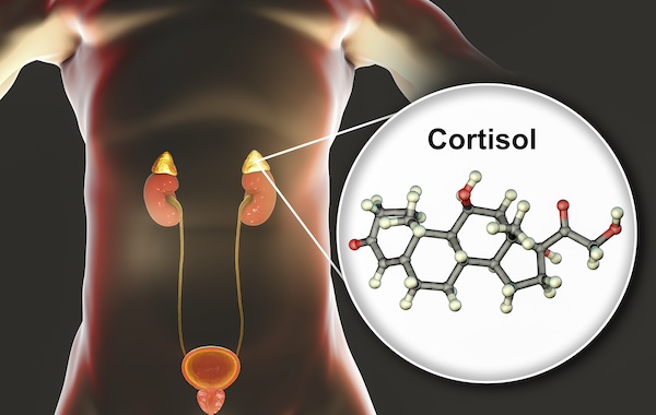 How the ‘stress hormone’ cortisol contributes to Cushing syndrome