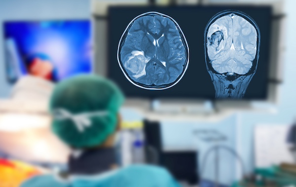 Trials assess novel nanoparticle’s impact on brain cancer patients