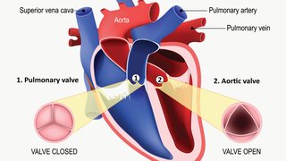 Ross procedure: Is this advanced aortic valve replacement right for you?