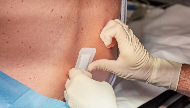 provider putting bandage on a spinal surgery patients back