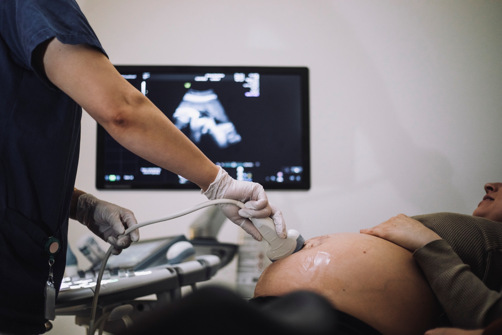 Fetal echocardiogram: What to expect