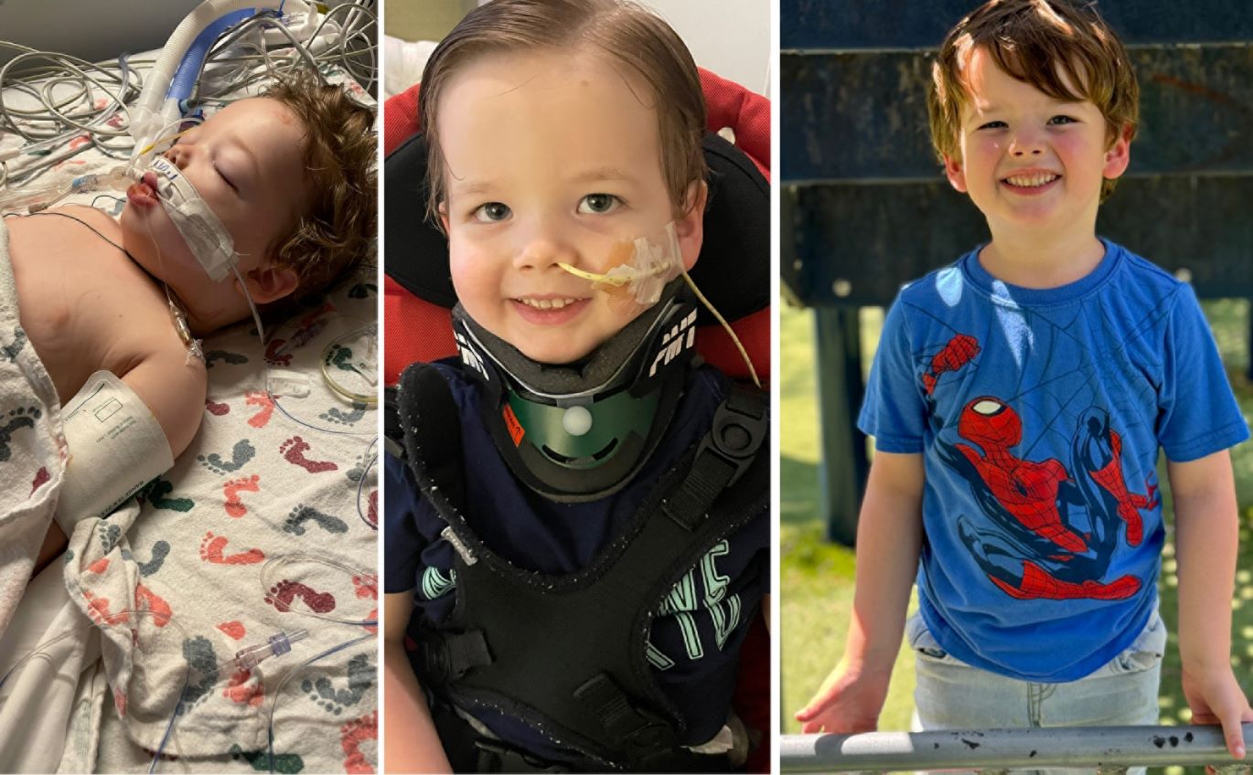 Photos of Owen Page in hospital after surgery, during his recovery and now.