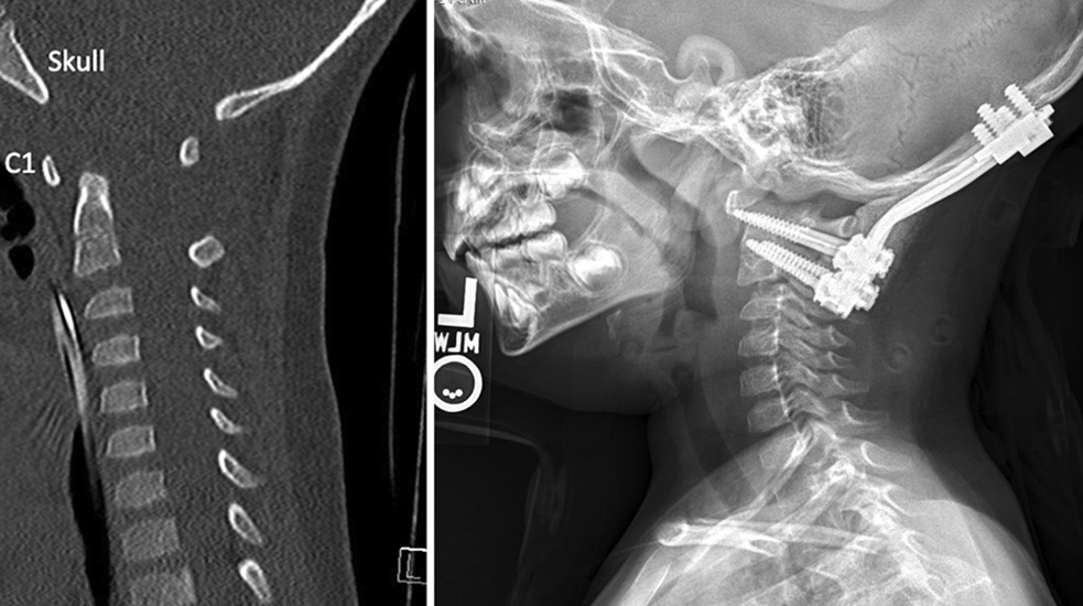 MRI and X-ray images of Owen Page