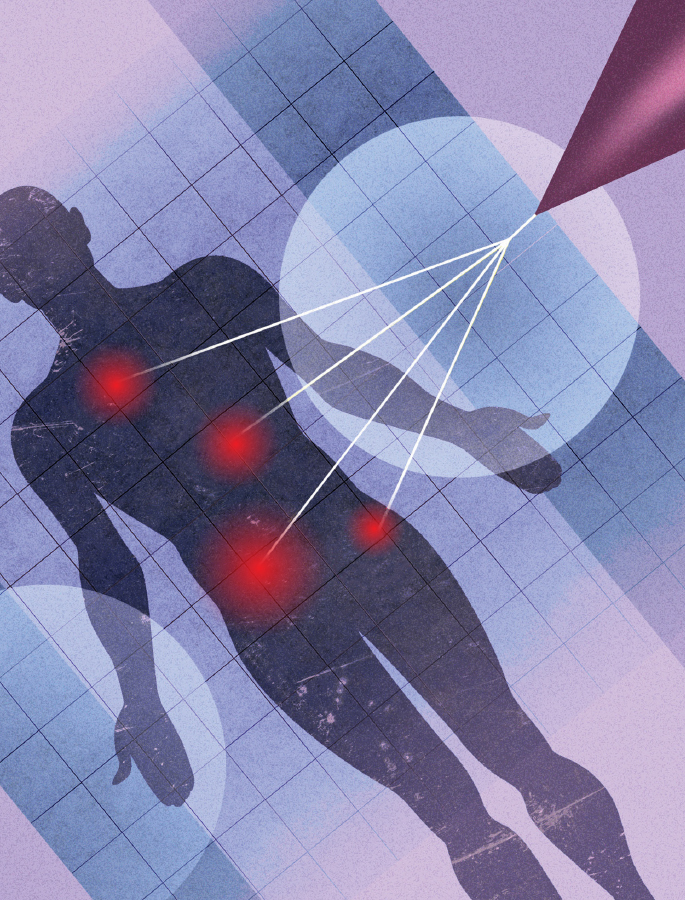 Digital illustration of the human body with highlighted target areas.