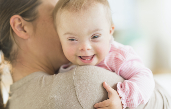 6 things to expect with babies with Down syndrome