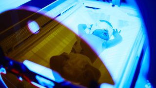 4 reasons why babies get jaundice and might require immediate treatment - Featured image
