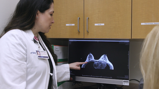 New approach to robotic mastectomy can preserve full breast and nipple sensation - Featured image